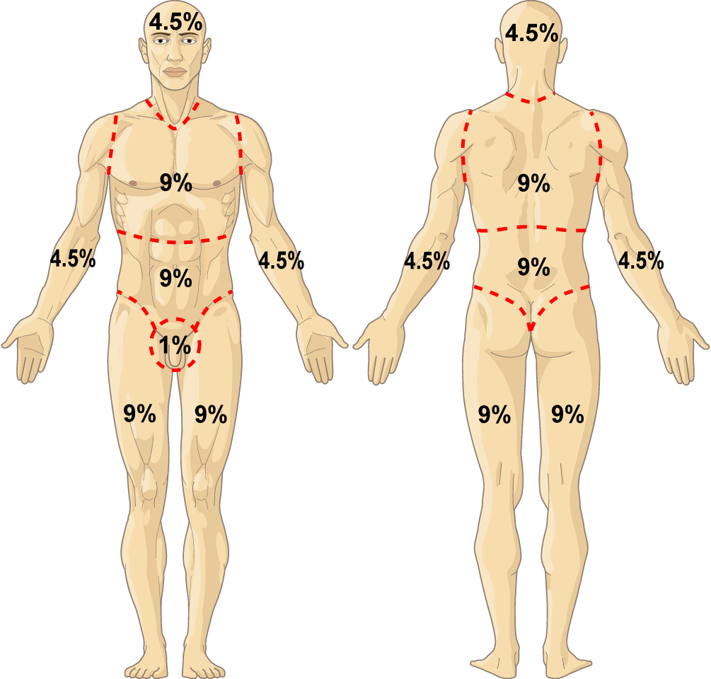 Rule Of Nines Qxmd